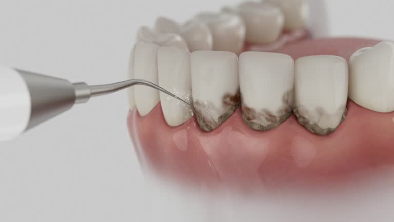Trusted Teeth Cleaning And Checkup service in Sixteen Mile Stand, OH - Dentist Open Now